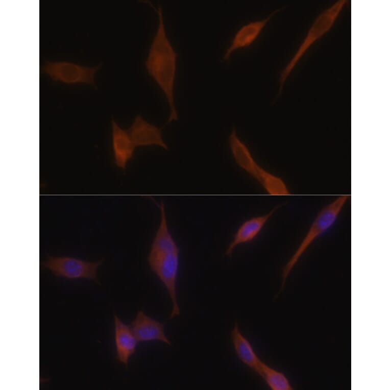 Immunofluorescence - Anti-MLPH Antibody (A9955) - Antibodies.com
