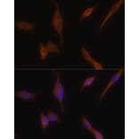 Immunofluorescence - Anti-MLPH Antibody (A9955) - Antibodies.com
