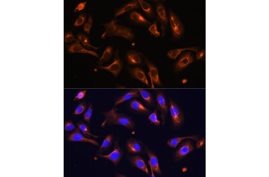 Immunofluorescence - Anti-MLPH Antibody (A9955) - Antibodies.com
