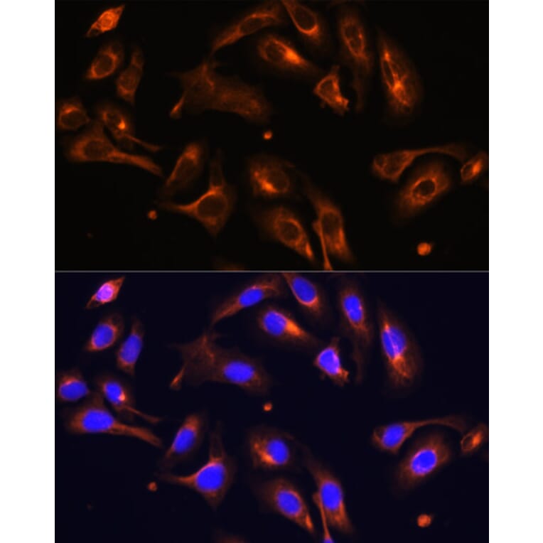 Immunofluorescence - Anti-MLPH Antibody (A9955) - Antibodies.com