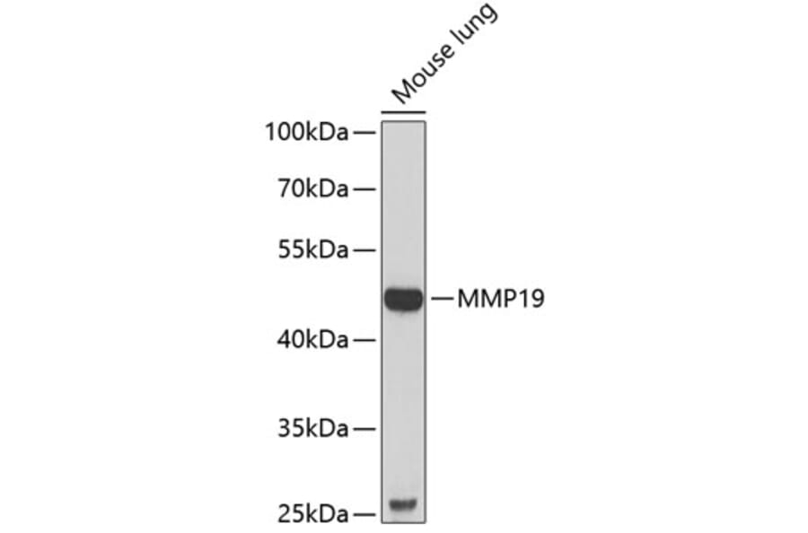 Western Blot - Anti-MMP19 Antibody (A9956) - Antibodies.com