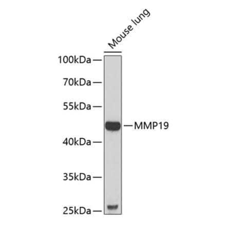 Western Blot - Anti-MMP19 Antibody (A9956) - Antibodies.com