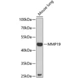 Western Blot - Anti-MMP19 Antibody (A9956) - Antibodies.com