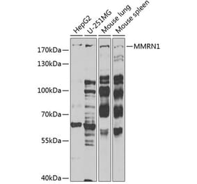 Western Blot - Anti-ECM Antibody (A9957) - Antibodies.com
