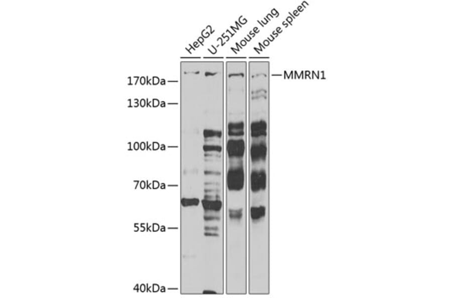 Western Blot - Anti-ECM Antibody (A9957) - Antibodies.com