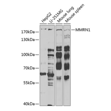 Western Blot - Anti-ECM Antibody (A9957) - Antibodies.com