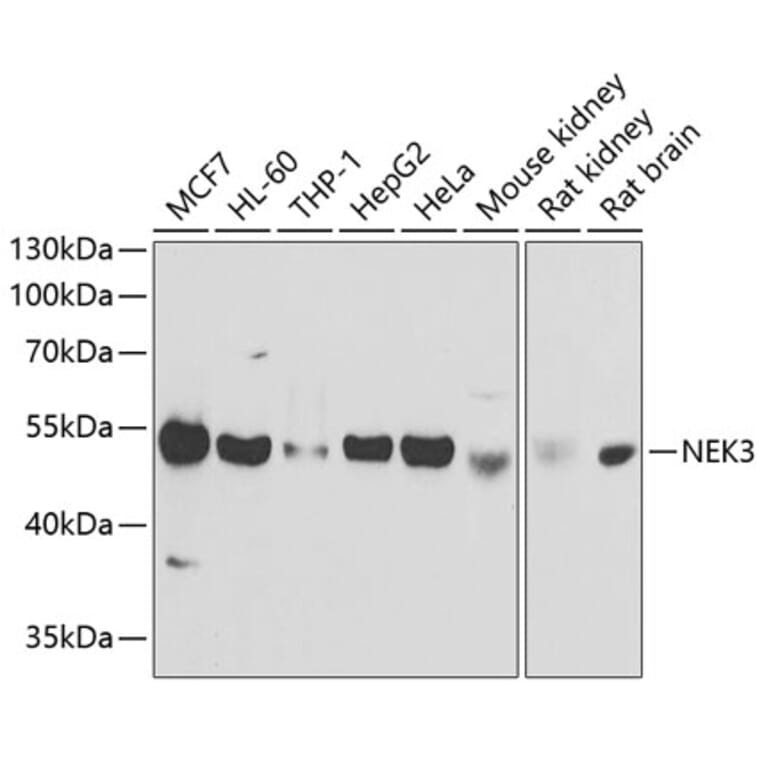 Western Blot - Anti-NEK3 Antibody (A9959) - Antibodies.com