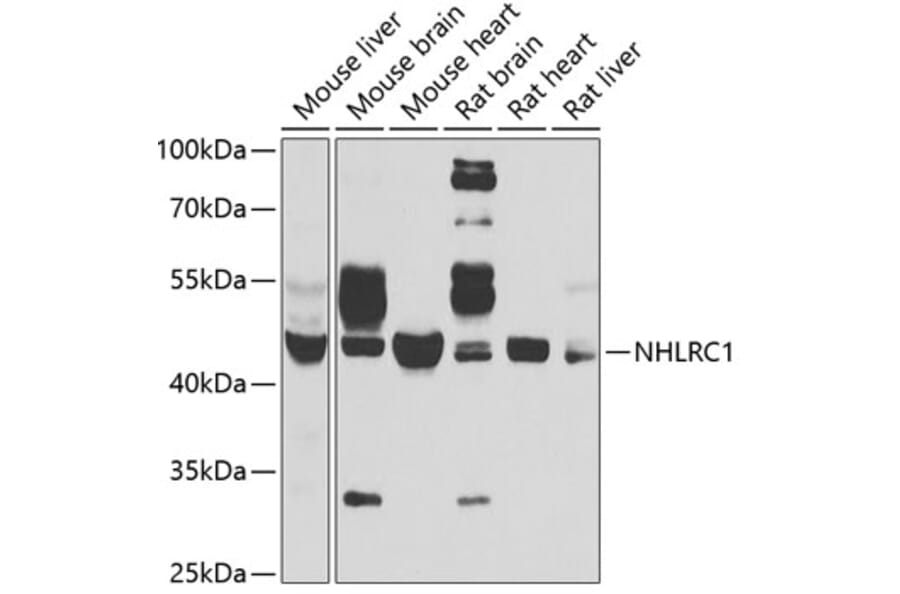Western Blot - Anti-NHLRC1/Malin Antibody (A9960) - Antibodies.com