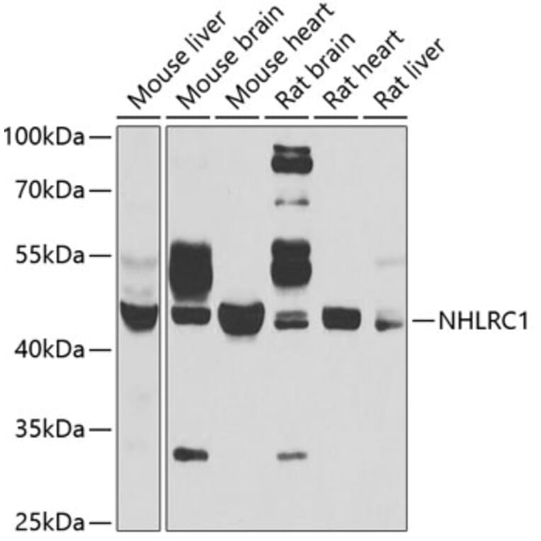 Western Blot - Anti-NHLRC1/Malin Antibody (A9960) - Antibodies.com