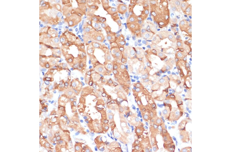 Immunohistochemistry - Anti-NHLRC1/Malin Antibody (A9960) - Antibodies.com