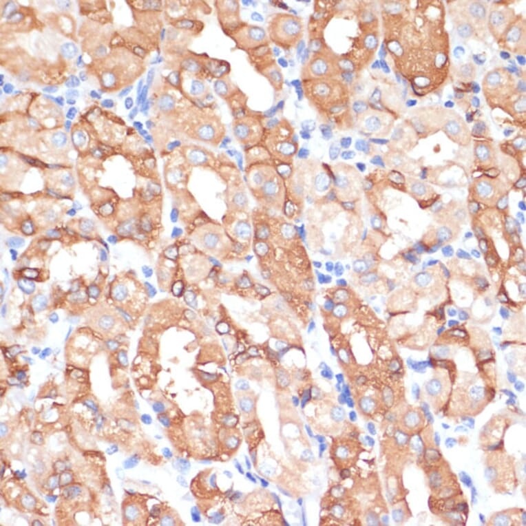 Immunohistochemistry - Anti-NHLRC1/Malin Antibody (A9960) - Antibodies.com
