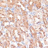 Immunohistochemistry - Anti-NHLRC1/Malin Antibody (A9960) - Antibodies.com