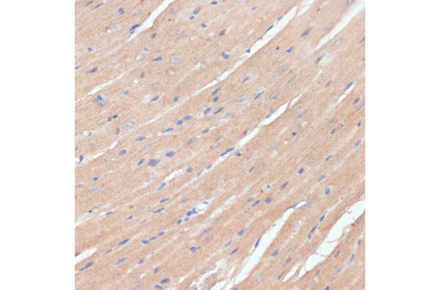 Immunohistochemistry - Anti-NHLRC1/Malin Antibody (A9960) - Antibodies.com