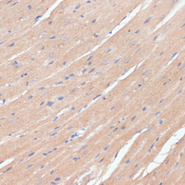 Immunohistochemistry - Anti-NHLRC1/Malin Antibody (A9960) - Antibodies.com