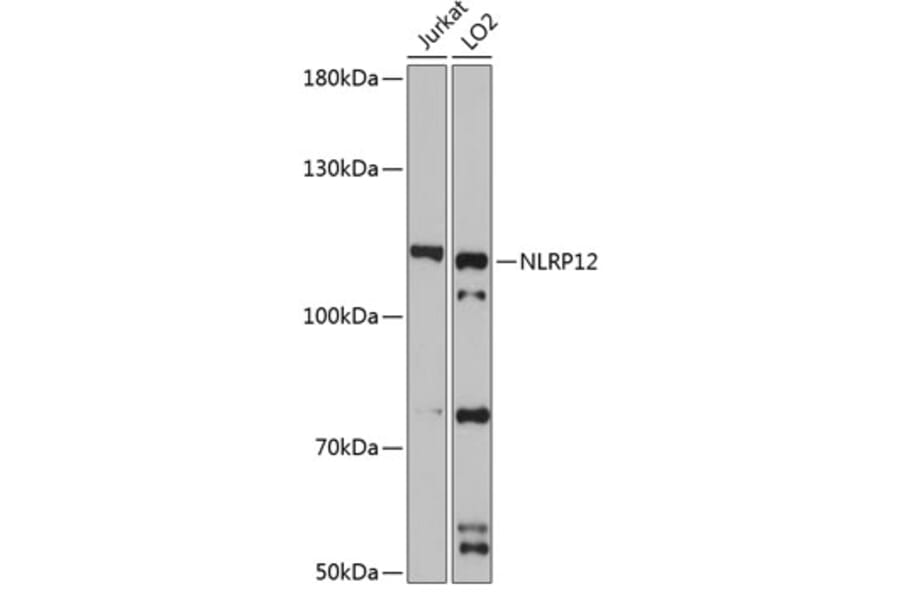 Western Blot - Anti-NALP12/NLRP12 Antibody (A9961) - Antibodies.com