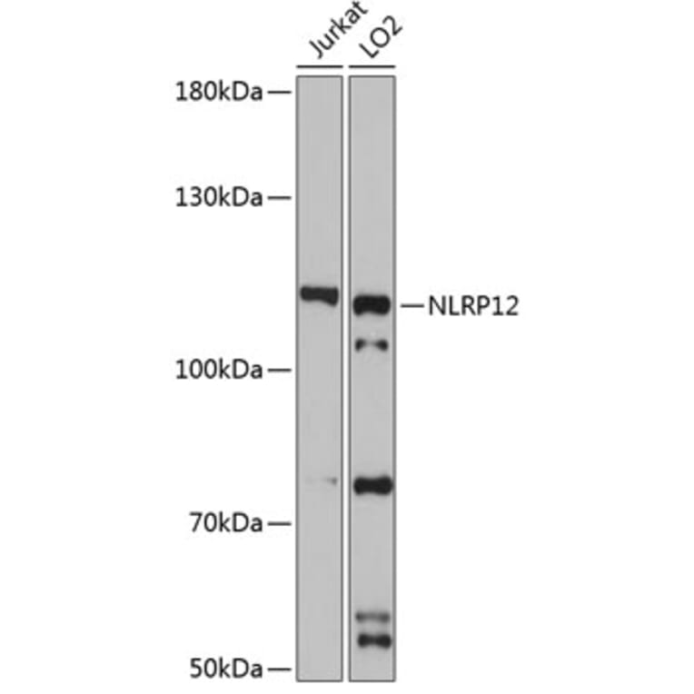 Western Blot - Anti-NALP12/NLRP12 Antibody (A9961) - Antibodies.com