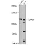 Western Blot - Anti-NALP12/NLRP12 Antibody (A9961) - Antibodies.com