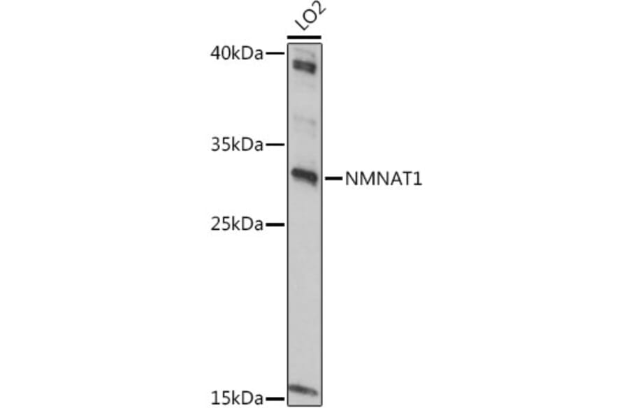 Western Blot - Anti-Nmnat1/NMNAT Antibody (A9962) - Antibodies.com