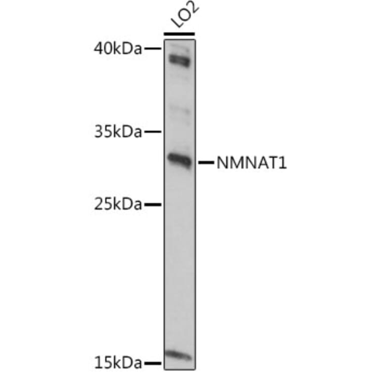 Western Blot - Anti-Nmnat1 / NMNAT Antibody (A9962) - Antibodies.com