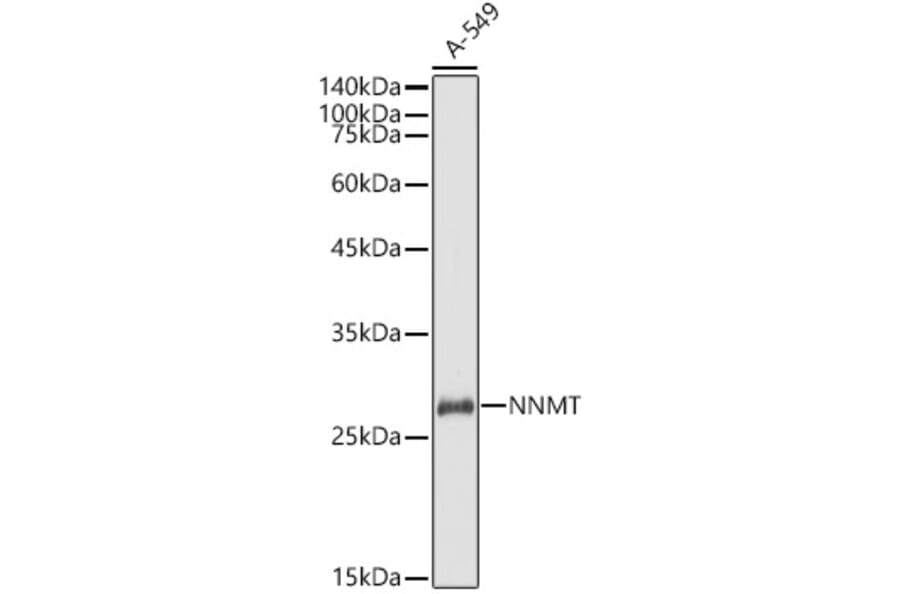 Western Blot - Anti-NNMT Antibody (A9963) - Antibodies.com