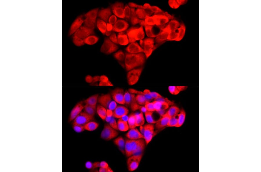 Immunofluorescence - Anti-NNMT Antibody (A9963) - Antibodies.com
