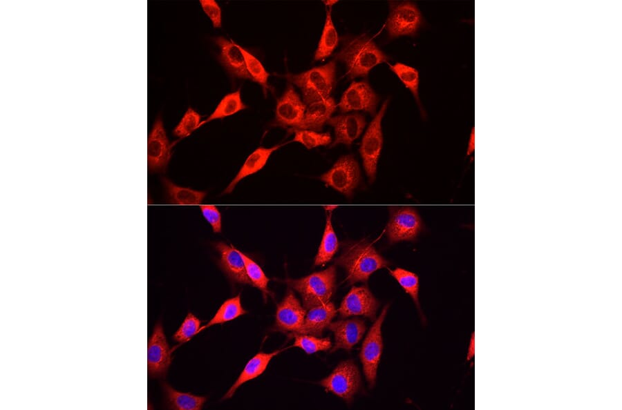 Immunofluorescence - Anti-NNMT Antibody (A9963) - Antibodies.com