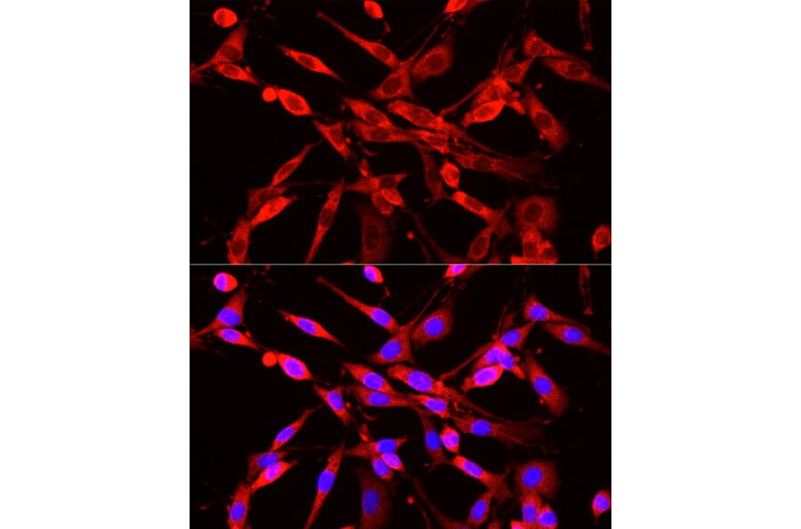 Immunofluorescence - Anti-NNMT Antibody (A9963) - Antibodies.com