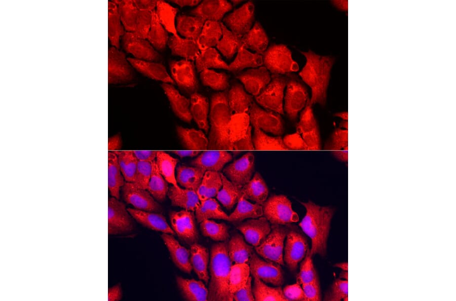 Immunofluorescence - Anti-NNMT Antibody (A9963) - Antibodies.com