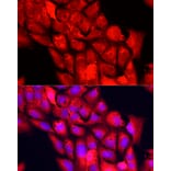 Immunofluorescence - Anti-NNMT Antibody (A9963) - Antibodies.com