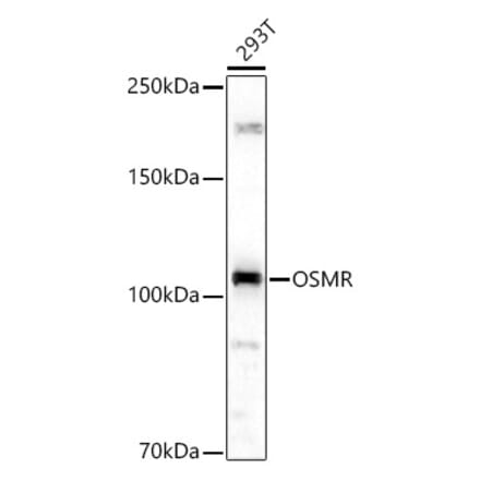 Western Blot - Anti-OSMR Antibody (A9965) - Antibodies.com