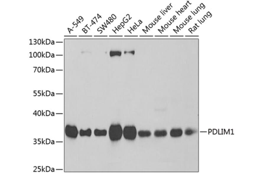 Western Blot - Anti-PDLIM1 Antibody (A6686) - Antibodies.com