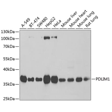 Western Blot - Anti-PDLIM1 Antibody (A6686) - Antibodies.com