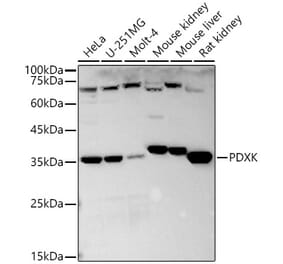 Western Blot - Anti-PDXK.1 Antibody (A9968) - Antibodies.com