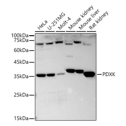 Western Blot - Anti-PDXK.1 Antibody (A9968) - Antibodies.com