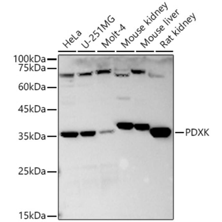 Western Blot - Anti-PDXK.1 Antibody (A9968) - Antibodies.com