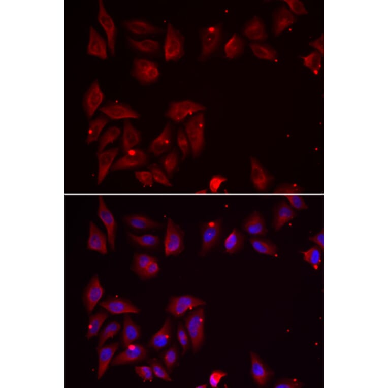 Immunofluorescence - Anti-PDXK.1 Antibody (A9968) - Antibodies.com