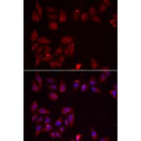 Immunofluorescence - Anti-PDXK.1 Antibody (A9968) - Antibodies.com