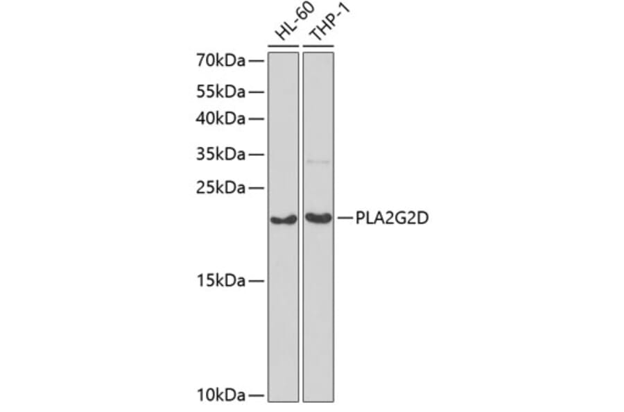 Western Blot - Anti-PLA2G2D Antibody (A6690) - Antibodies.com