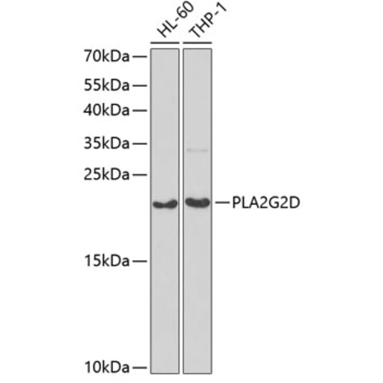 Western Blot - Anti-PLA2G2D Antibody (A6690) - Antibodies.com