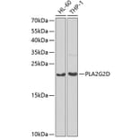 Western Blot - Anti-PLA2G2D Antibody (A6690) - Antibodies.com