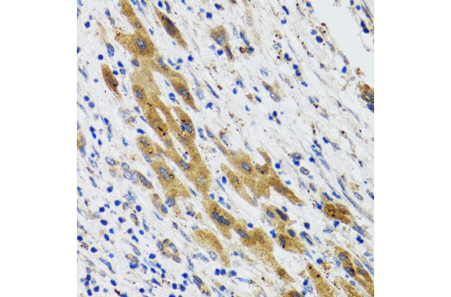 Immunohistochemistry - Anti-PLA2G2D Antibody (A6690) - Antibodies.com