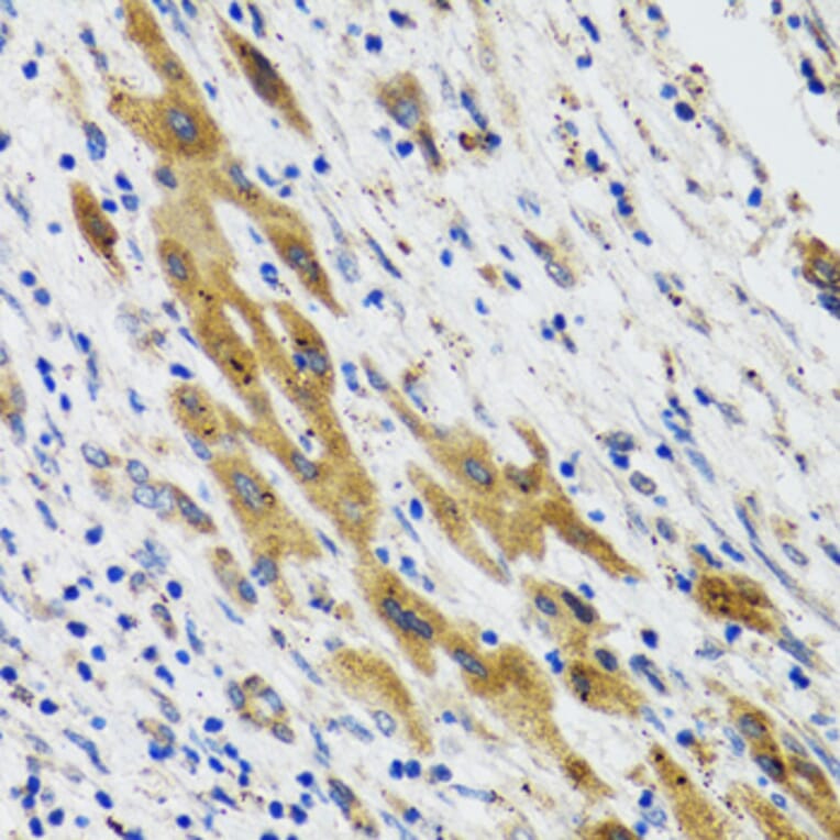 Immunohistochemistry - Anti-PLA2G2D Antibody (A6690) - Antibodies.com