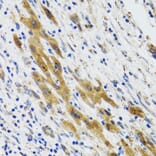 Immunohistochemistry - Anti-PLA2G2D Antibody (A6690) - Antibodies.com