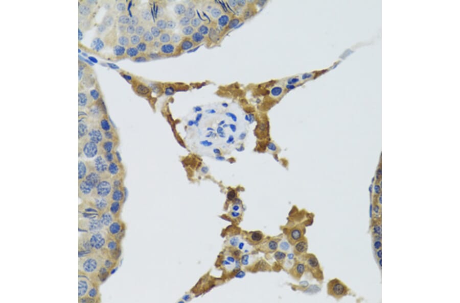 Immunohistochemistry - Anti-PLA2G2D Antibody (A6690) - Antibodies.com