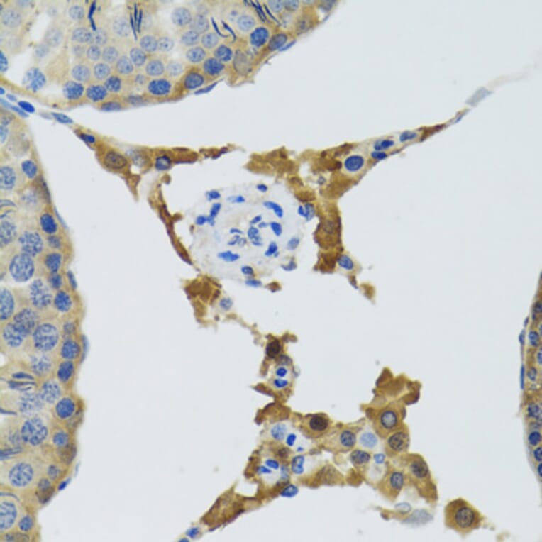 Immunohistochemistry - Anti-PLA2G2D Antibody (A6690) - Antibodies.com
