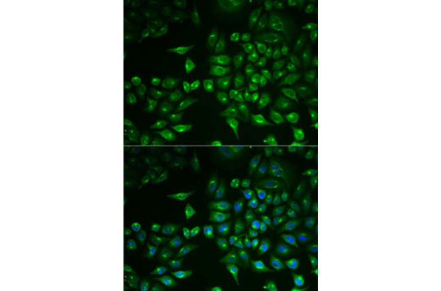 Immunofluorescence - Anti-PLA2G2D Antibody (A6690) - Antibodies.com