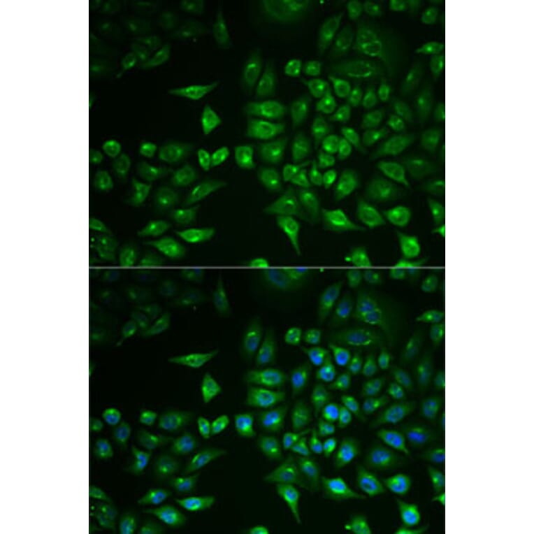 Immunofluorescence - Anti-PLA2G2D Antibody (A6690) - Antibodies.com