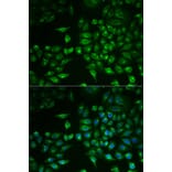 Immunofluorescence - Anti-PLA2G2D Antibody (A6690) - Antibodies.com