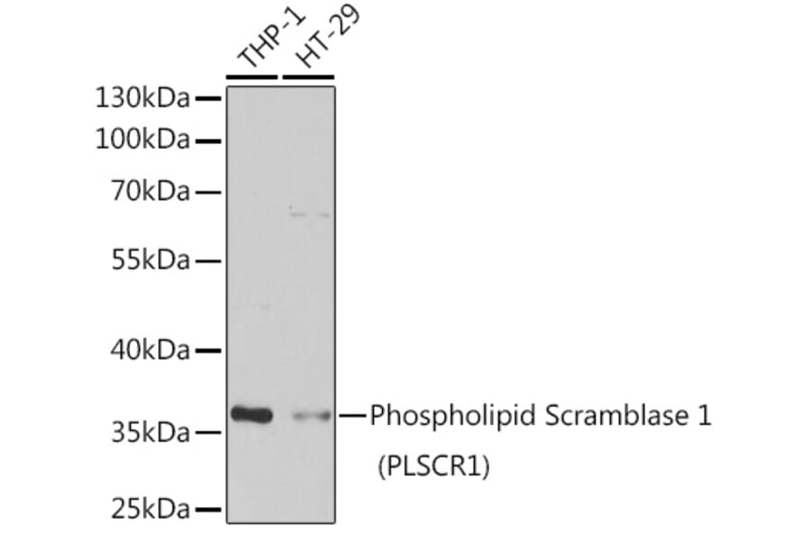 Western Blot - Anti-Scramblase 1 Antibody (A9970) - Antibodies.com