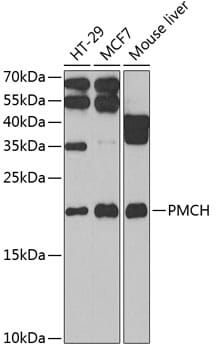 Western blot analysis of extracts of various cell lines, using Anti-PMCH Antibody (A6692) at 1:1,000 dilution.
Secondary antibody: Goat Anti-Rabbit IgG (H+L) (HRP) (AS014) at 1:10,000 dilution.
Lysates / proteins: 25µg per lane.
Blocking buffer: 3% non-fat dry milk in TBST.
Detection: ECL Basic Kit (RM00020).
Exposure time: 10s.